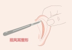 注射式丰下巴让你更美丽