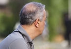 8种治疗男人口干口苦的方法