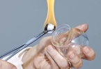 拔罐后 从皮肤颜色看健康
