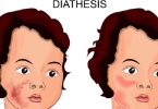 如何美白全身？美白的方法有哪些？