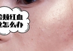 怎么让您拥有健康的肌肤 牢记肌肤保养四步曲