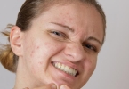 如何拥有美白肌肤教你有效防晒 怎么拥有美白肌肤教你有效防晒