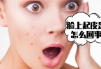 茶树精油的功效与作用  互叶白千层茶树精油