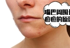 脸上长痘痘是什么原因 怀孕脸上长痘痘怎么回事