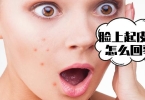 怎么预防青春痘比较好 7个妙招只要青春不要痘