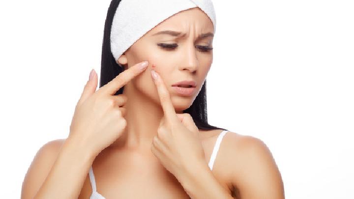 女生如何快速祛痘？祛痘的方法有哪些？