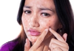 女人如何美白？推荐美白的方法