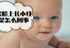 眼部如何保养美容 常按五穴位保养眼部肌肤