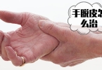 冬天手上皮肤发黑？5种原因要了解