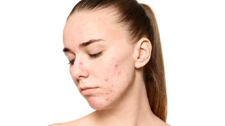 脸上长痘痘吃什么水果排毒？脸上长痘痘食疗排毒方法