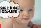 tbs茶树精油  茶树精油祛痘使用方法