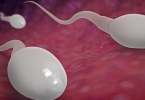 精子畸形和染色体异常关系