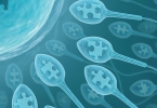 中医有招治疗精子异常不育