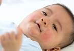 孩子营养不良谁的错 给患儿吃些什么好