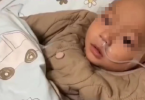8个月宝宝确诊溶血症全身换血6次，什么是溶血症？