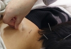 男性患有无精症选择什么治疗方法