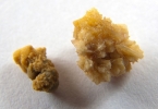 痔疮一般都有什么症状呢？