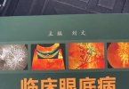 城中之城：赵行长稳住！视网膜色素变性还可以这样治疗