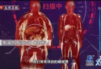 明明四肢纤细，肚子却很大？绿瘦：你可能是“腹型肥胖”！