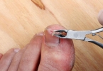 甲沟炎最底下那层怎么夹出来