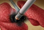 如何判断是不是癌性腹水？