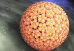 肠上管状腺瘤严重吗