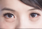 眼睑缘炎痒和红肿怎么治疗