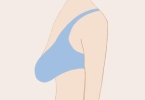 做乳房下垂矫正修复能维持多久