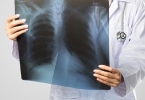 肺大疱是什么病严重吗怎么治疗