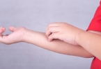 疱疹最怕的三种菜,真的存在吗?
