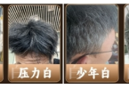 桂圆琼玉颗粒：科学调理早生白发，重启青丝生命力