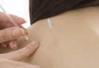 乳腺增生针灸有效果吗？