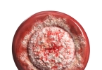 八爪鱼紧缩手术多久可以同房(晋城阴道紧缩哪家医院好)