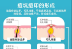 祛痘印用什么好？2025科学淡印清单TOP10！榜首效果太硬核，可以直接抄作业！