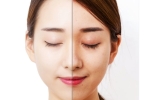 告别黑眼圈，重拾明亮双眸