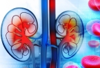 螺旋CT：疾病筛查的得力助手