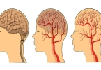 儿童癫痫病人的检查有哪些方法