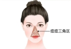 背上长痘痘是什么情况