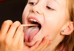 舌苔有裂纹是怎么回事