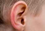 什么是小耳畸形整形