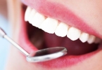 怎么去除牙结石不洗牙