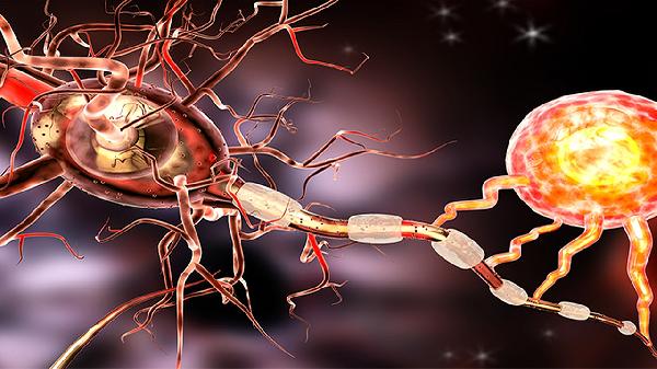 肋间神经炎的注意事项有哪些