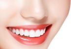牙齿美容冠好不好