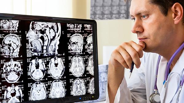 脑血栓怎么治疗能消除