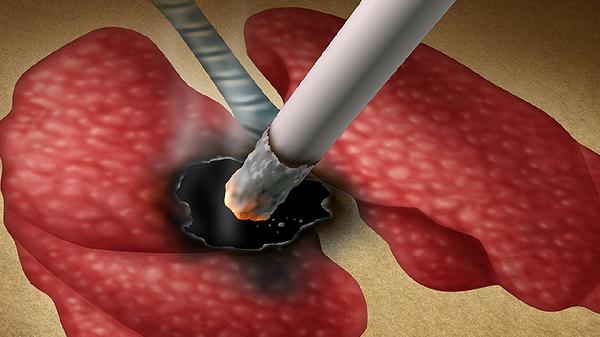 吸烟有害健康是“骗局”？尼古丁根本不致癌？医生：真相更加残酷