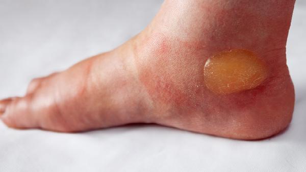 足底疼痛的位置怎么回事，怎么办