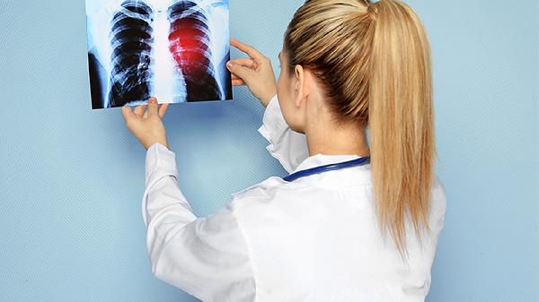 支原体和衣原体肺炎感染有什么症状