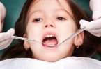 5岁宝宝蛀牙怎么补救