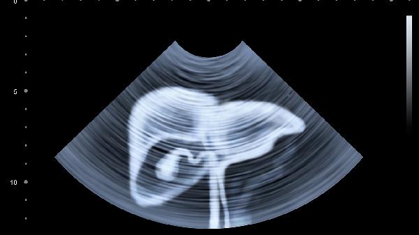 腹部经常疼而且经常放屁