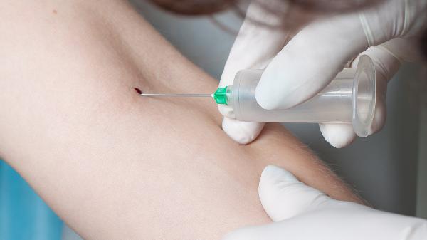 血脂检查的指标有哪些